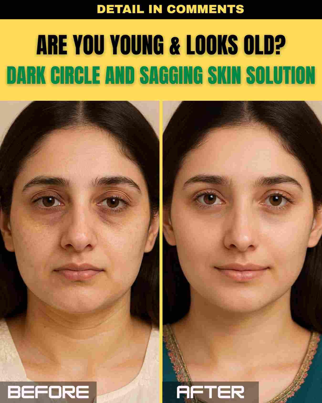 ARE YOU YOUNG & LOOK OLD? DARK CIRCLE AND SAGGING SKIN SOLUTION