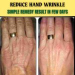 REDUCE HAND WRINKLES – SIMPLE REMEDY WITH RESULTS IN FEW DAYS