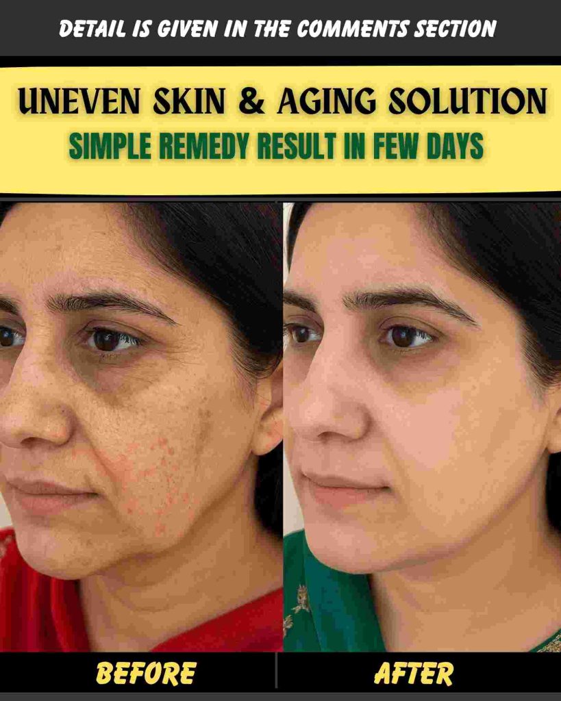 UNEVEN SKIN & AGING SOLUTION – SIMPLE REMEDY WITH RESULTS IN FEW DAYS
