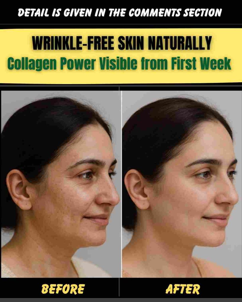 WRINKLE-FREE SKIN NATURALLY – COLLAGEN POWER VISIBLE FROM FIRST WEEK