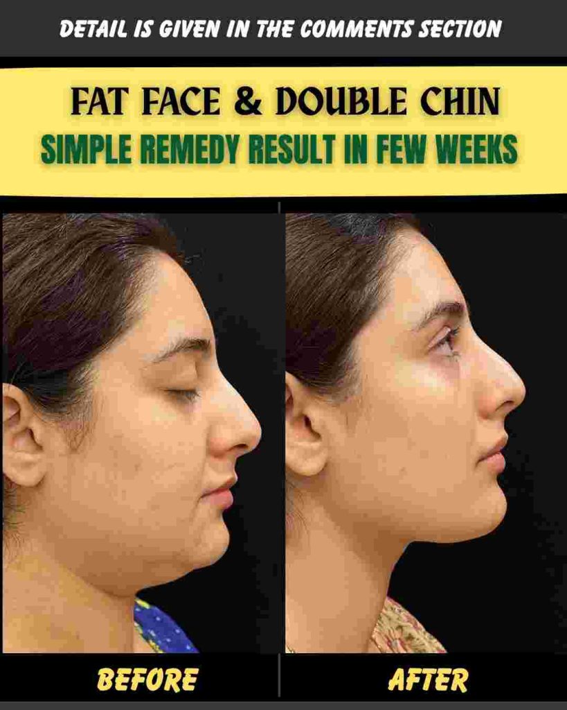 FAT FACE & DOUBLE CHIN SIMPLE REMEDY RESULT IN FEW WEEKS