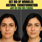 GET RID OF WRINKLES & NATURAL TRANSFORMATION JUST DO THIS FOR 2 WEEKS