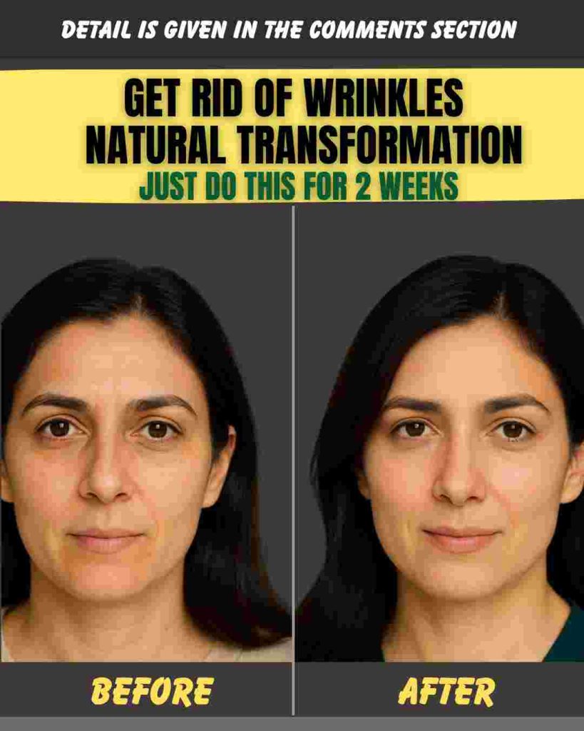 GET RID OF WRINKLES & NATURAL TRANSFORMATION JUST DO THIS FOR 2 WEEKS