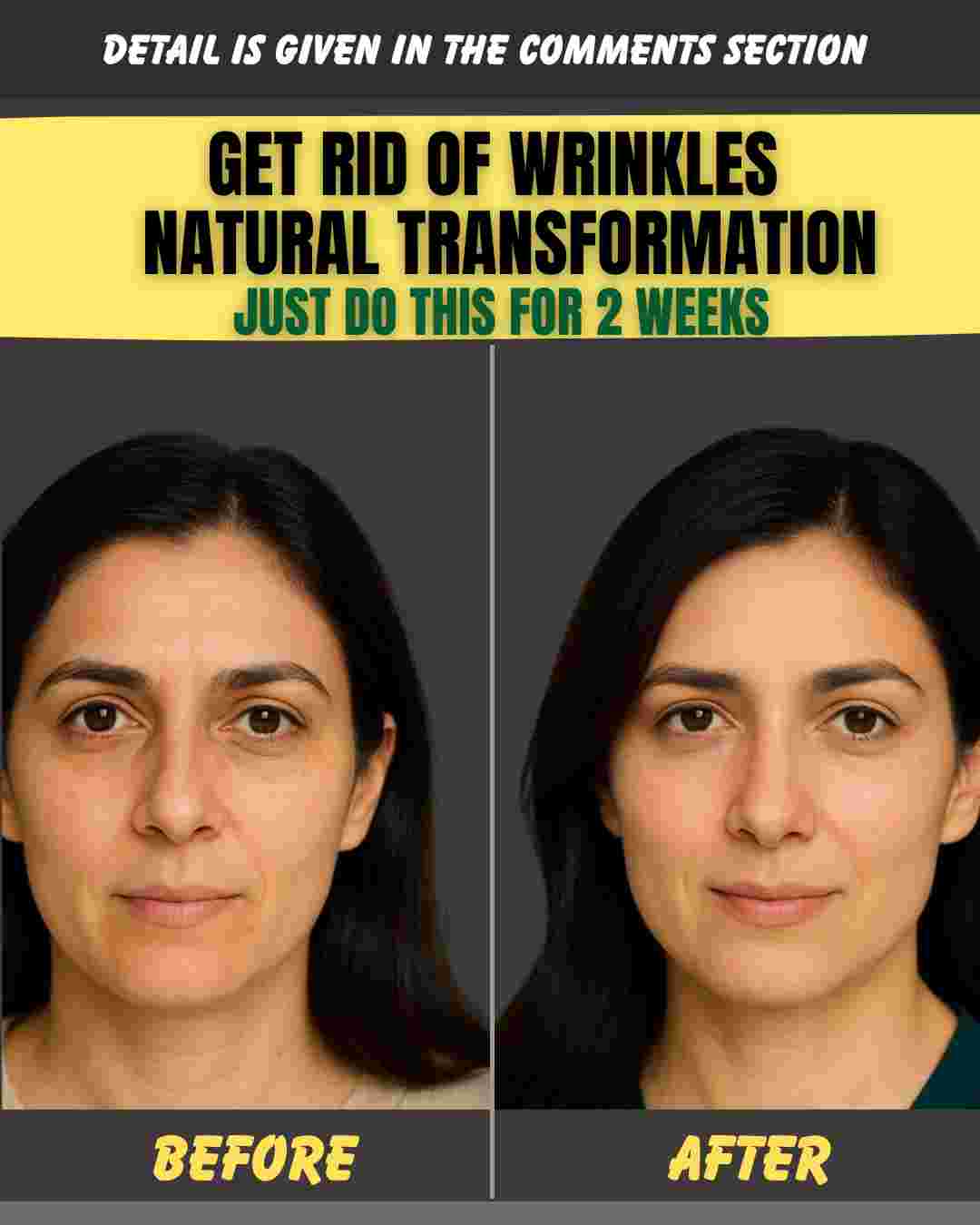 GET RID OF WRINKLES & NATURAL TRANSFORMATION: JUST DO THIS FOR 2 WEEKS