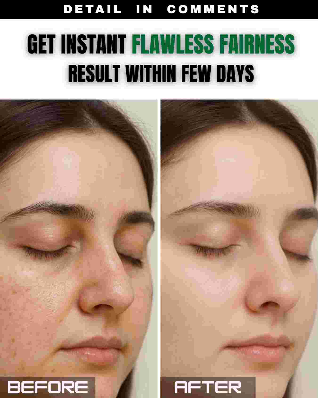 Get Instant Flawless Fairness Result Within Few Days – 100% Natural Home Remedies