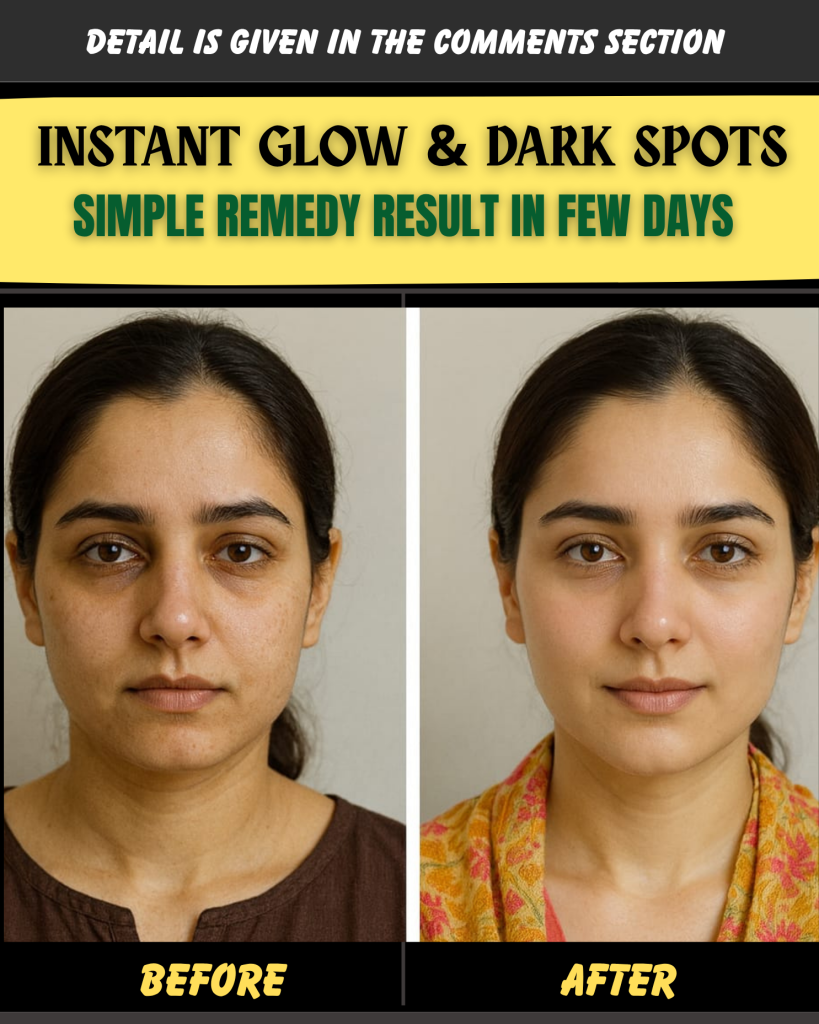 INSTANT GLOW & DARK SPOTS – SIMPLE REMEDY RESULT IN FEW DAYS