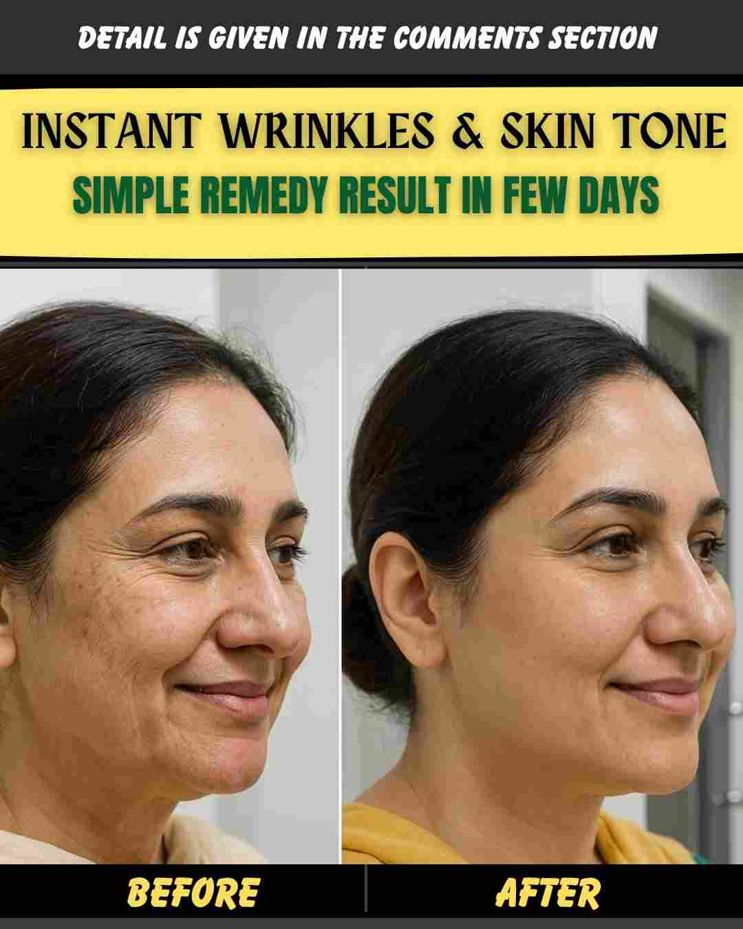 INSTANT WRINKLES & SKIN TONE SIMPLE REMEDY – RESULT IN FEW DAYS
