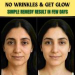NO WRINKLES & GET GLOW – SIMPLE REMEDY RESULT IN FEW DAYS
