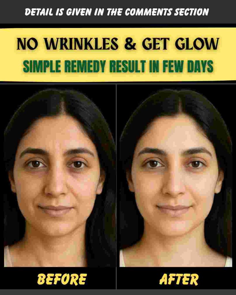 NO WRINKLES & GET GLOW – SIMPLE REMEDY RESULT IN FEW DAYS