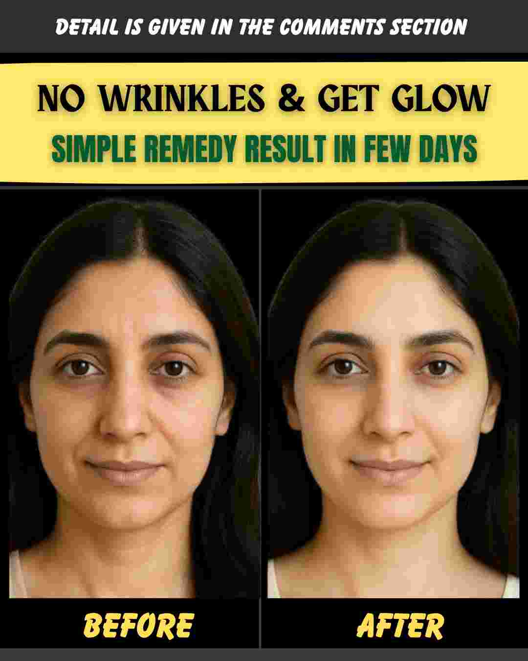 NO WRINKLES & GET GLOW – SIMPLE REMEDY RESULT IN FEW DAYS
