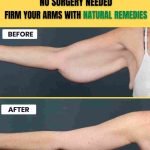 No Surgery Needed – Firm Your Arms with Natural Remedies