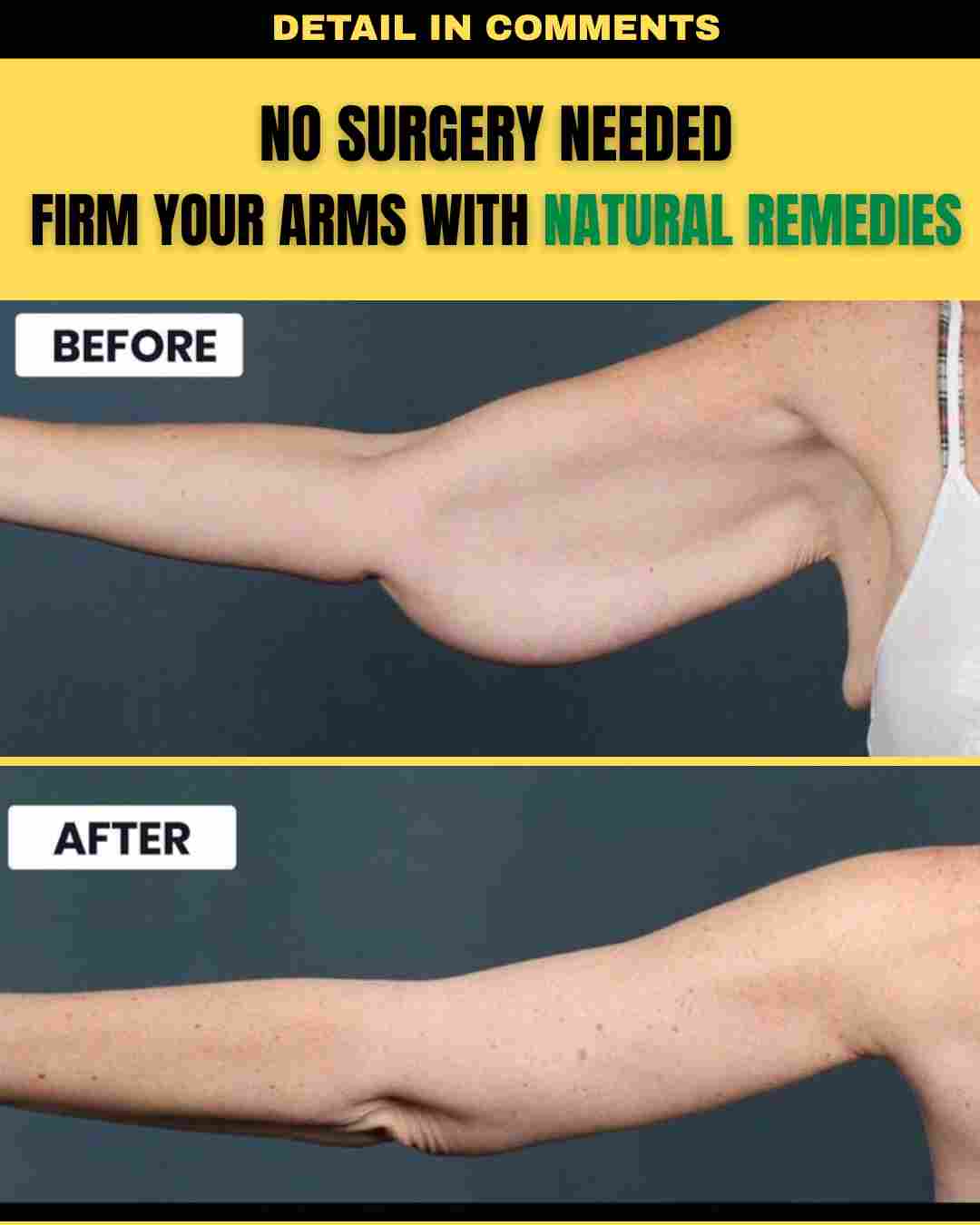 No Surgery Needed – Firm Your Arms with Natural Remedies