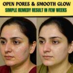 Open Pores & Smooth Glow Simple Natural Remedies with Visible Results in a Few Weeks