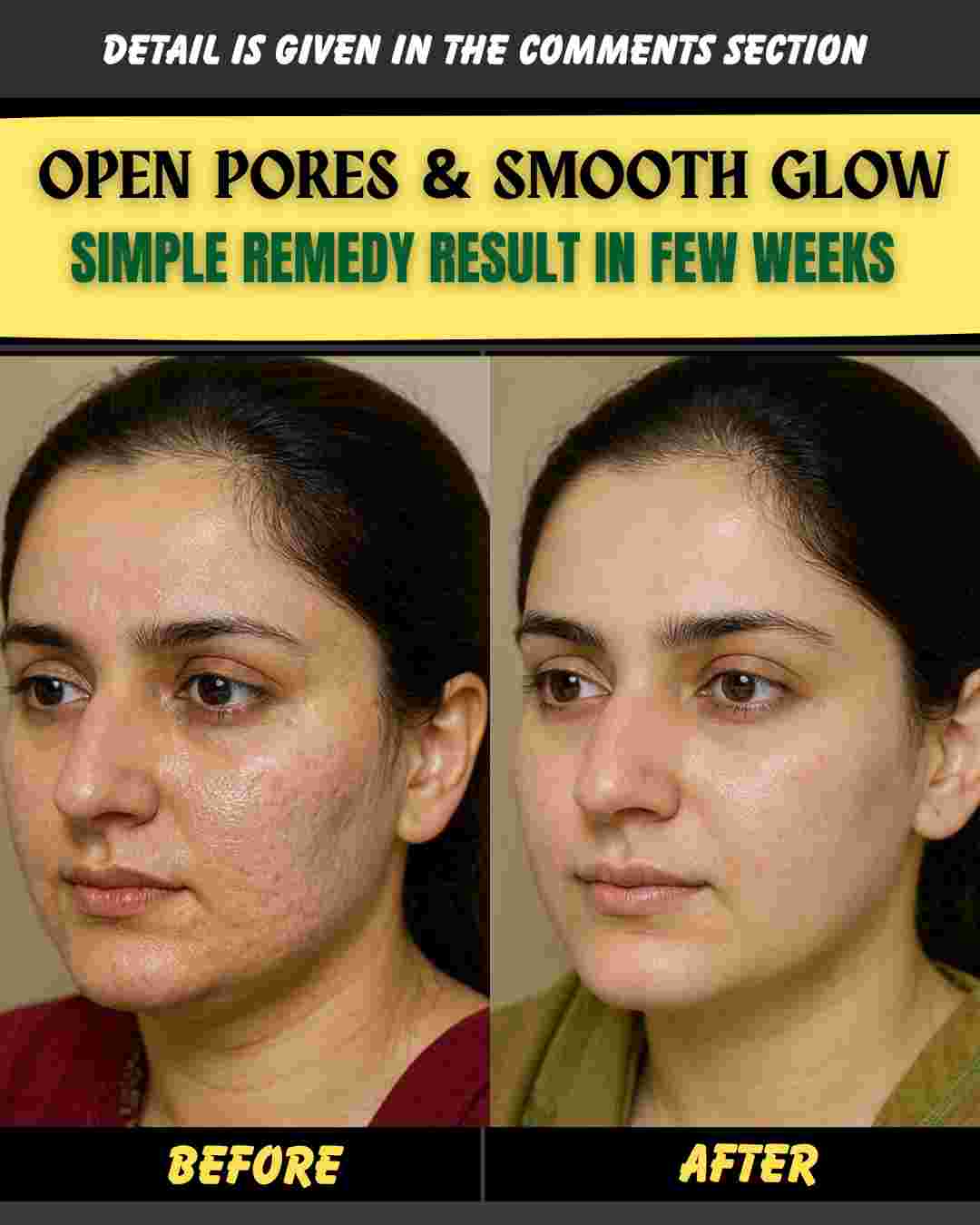 Open Pores & Smooth Glow Simple Natural Remedies with Visible Results in a Few Weeks