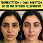 PIGMENTATION 7 DAYS SOLUTION – CLEAR, EVEN-TONED SKIN NATURALLY