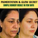 PIGMENTATION & GLOW SECRET SIMPLE REMEDY WITH RESULTS IN FEW DAYS