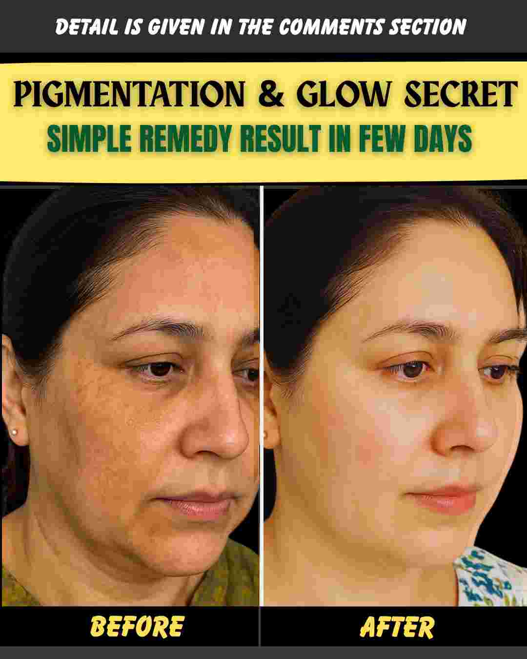PIGMENTATION & GLOW SECRET SIMPLE REMEDY WITH RESULTS IN FEW DAYS