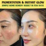 PIGMENTATION & INSTANT GLOW SIMPLE HOME REMEDY – RESULT IN FEW DAYS