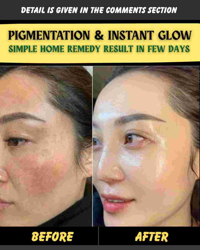 PIGMENTATION & INSTANT GLOW SIMPLE HOME REMEDY – RESULT IN FEW DAYS