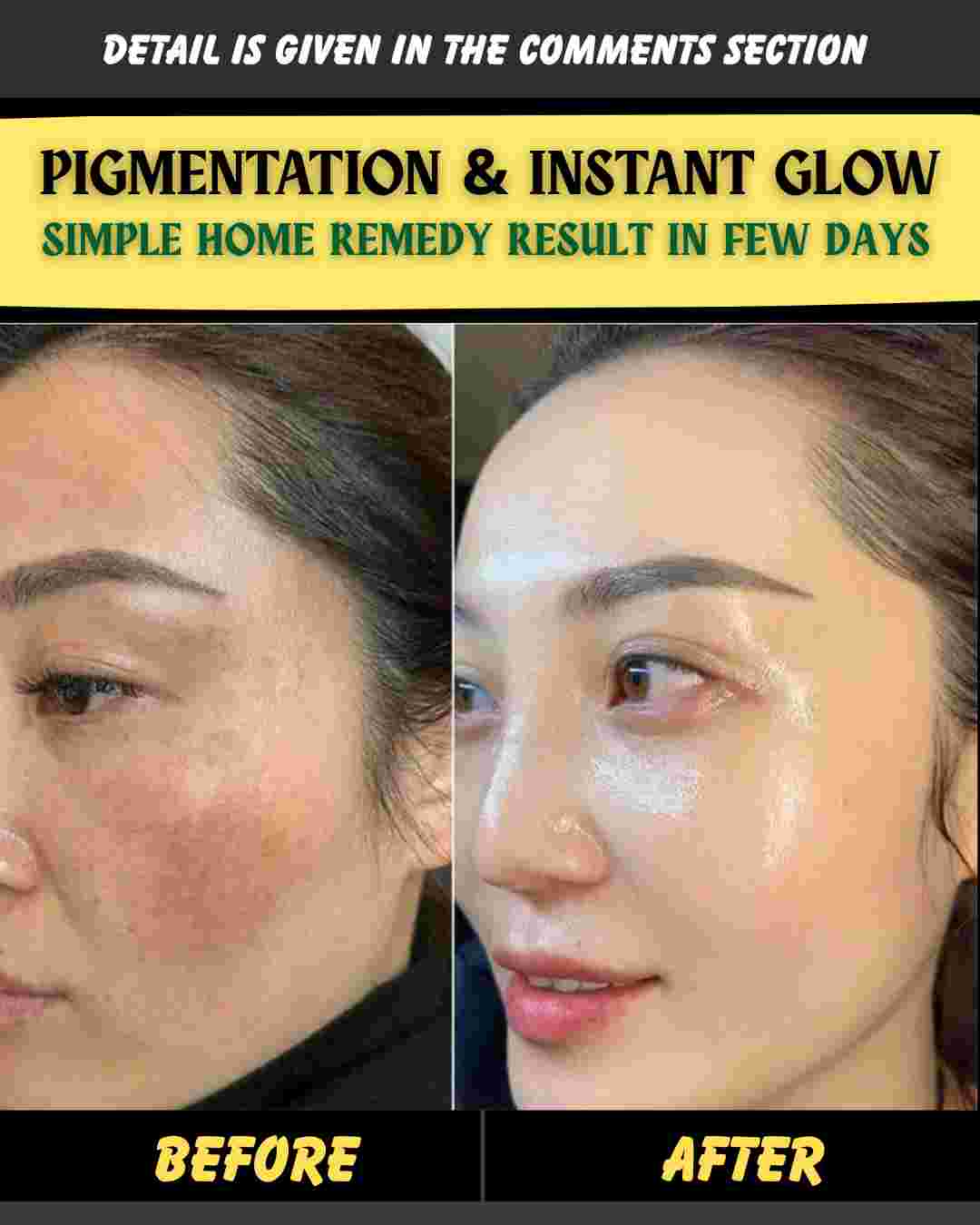 PIGMENTATION & INSTANT GLOW SIMPLE HOME REMEDY – RESULT IN FEW DAYS