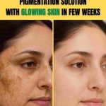 PIGMENTATION SOLUTION WITH GLOWING SKIN IN FEW WEEKS