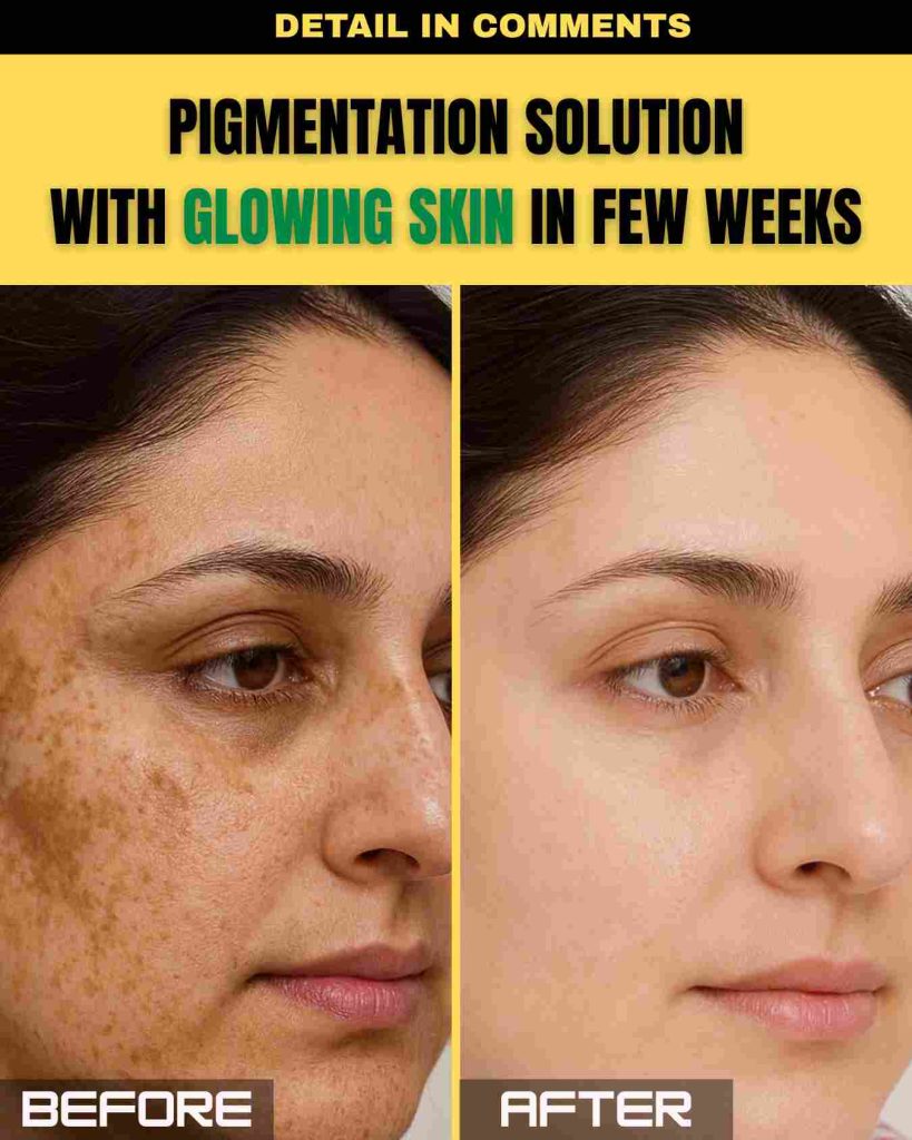 PIGMENTATION SOLUTION WITH GLOWING SKIN IN FEW WEEKS
