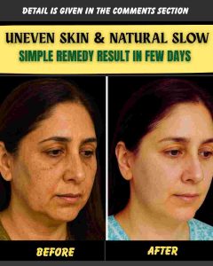 Uneven Skin & Natural Glow Simple Home Remedies That Show Results in a Few Days