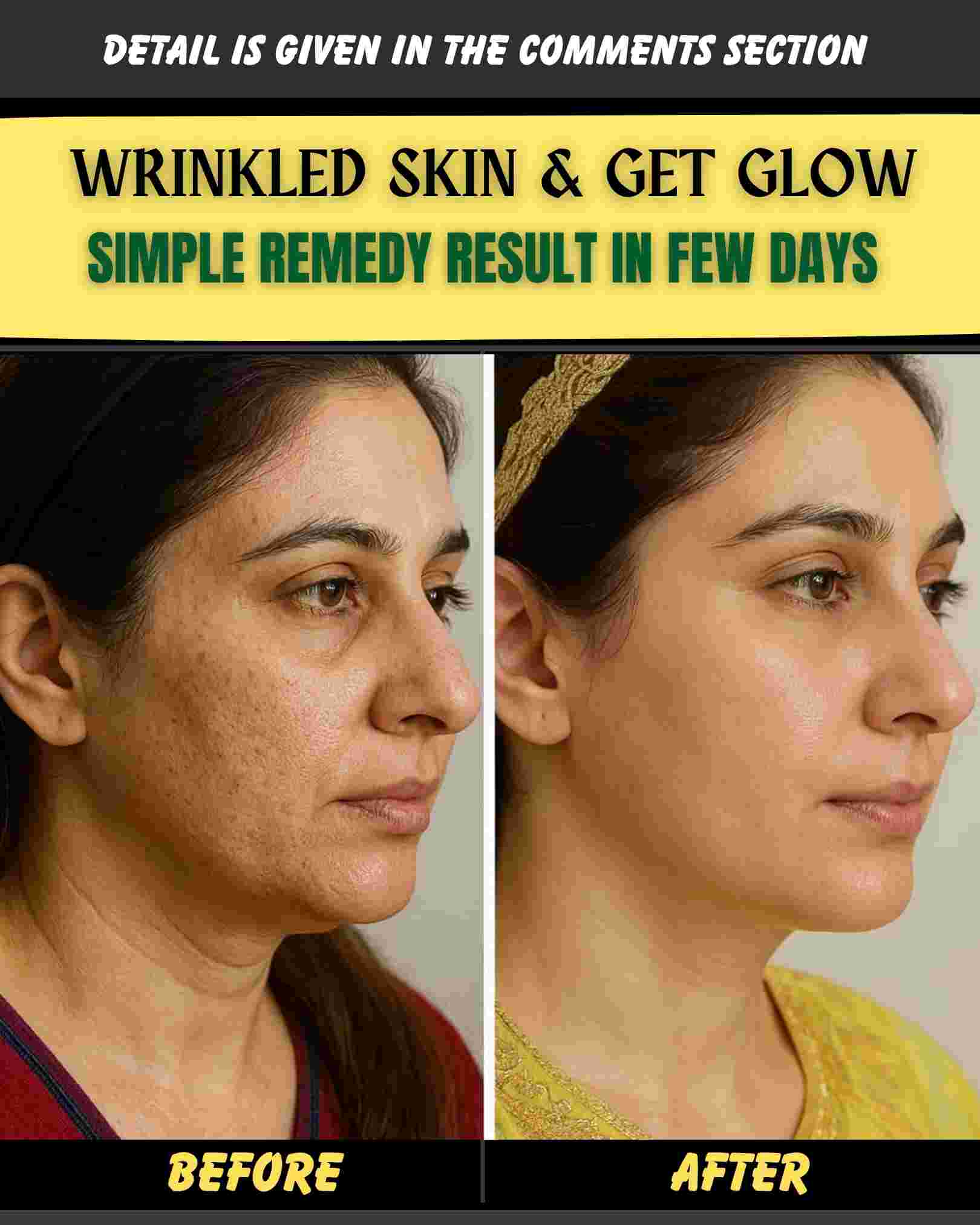 WRINKLED SKIN & GET GLOW SIMPLE REMEDY RESULT IN FEW DAYS