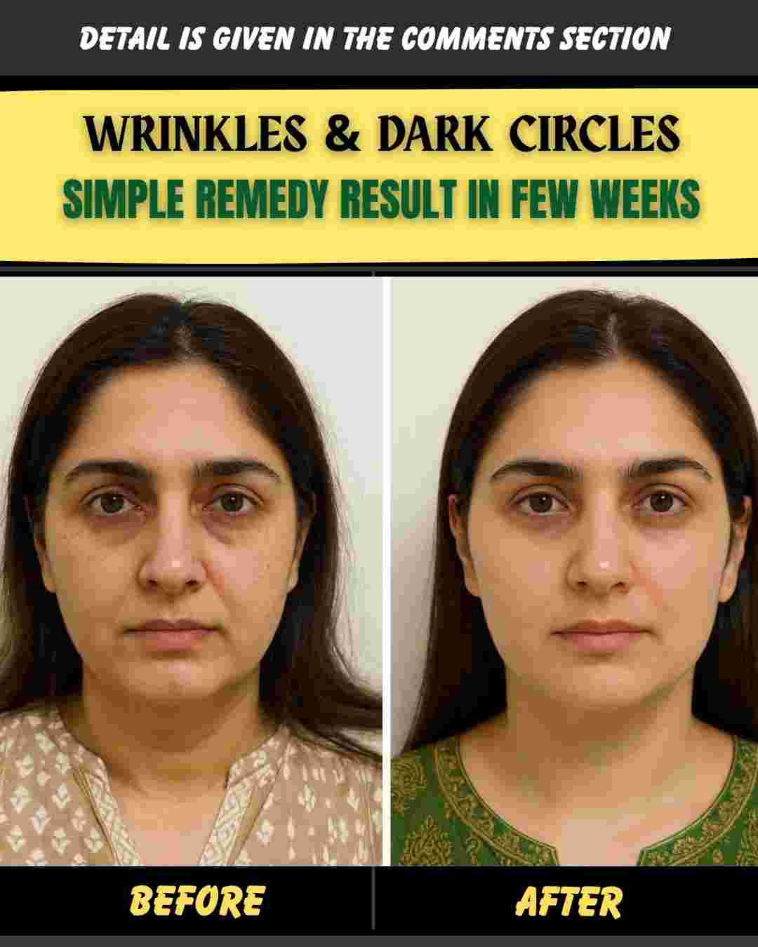 WRINKLES & DARK CIRCLES SIMPLE REMEDY – RESULT IN FEW WEEKS