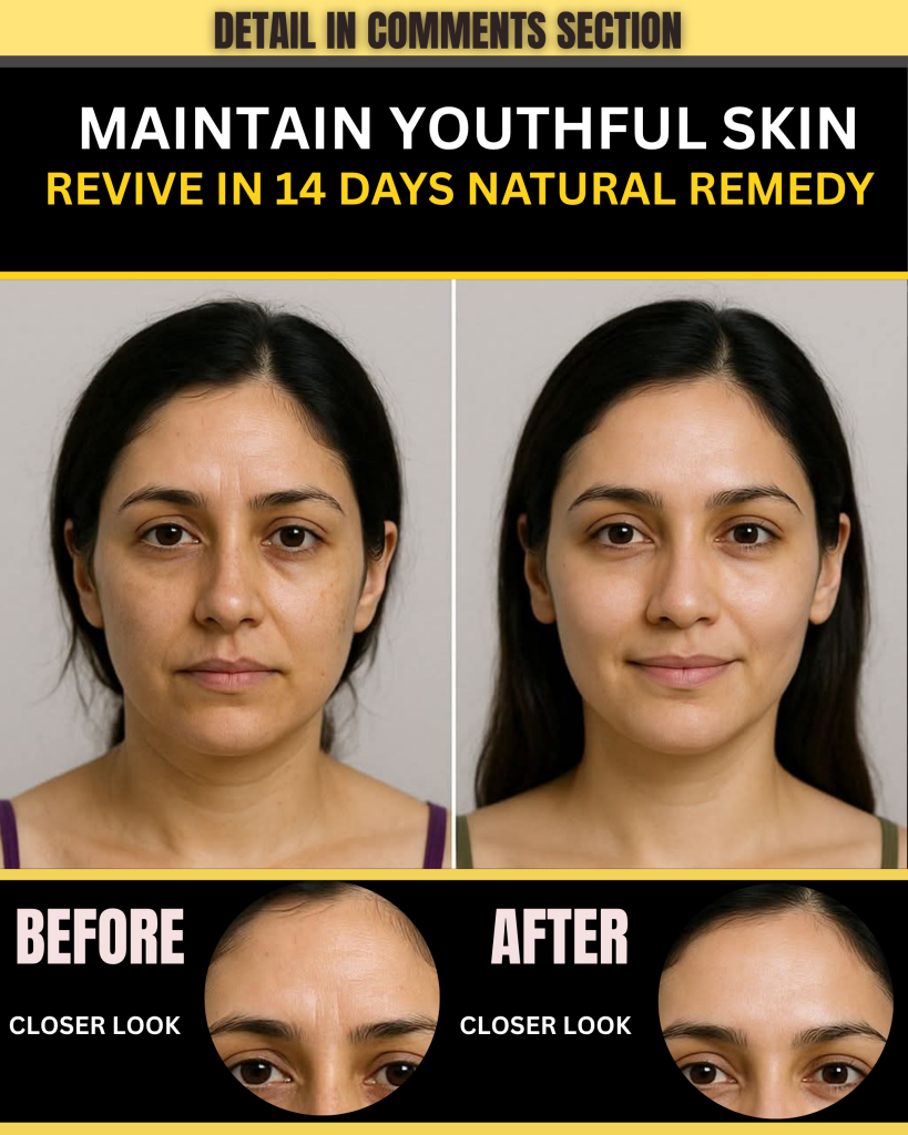 MAINTAIN YOUTHFUL SKIN – REVIVE IN 14 DAYS NATURAL REMEDY