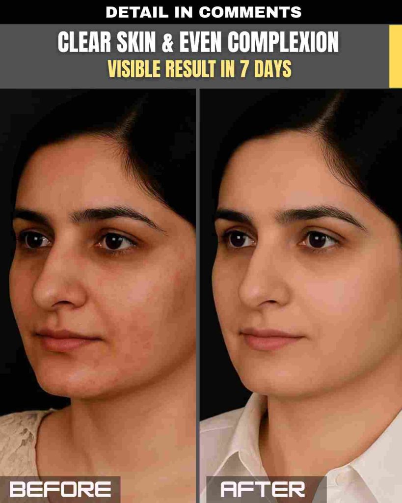 Clear Skin & Even Complexion – Visible Results in Just 7 Days!