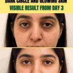 DARK CIRCLE AND GLOWING SKIN – VISIBLE RESULTS FROM DAY 3