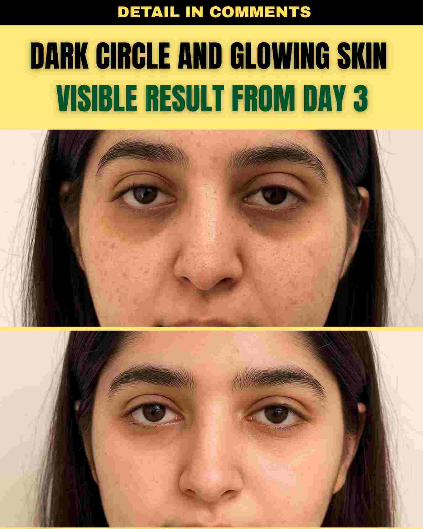 DARK CIRCLE AND GLOWING SKIN – VISIBLE RESULTS FROM DAY 3
