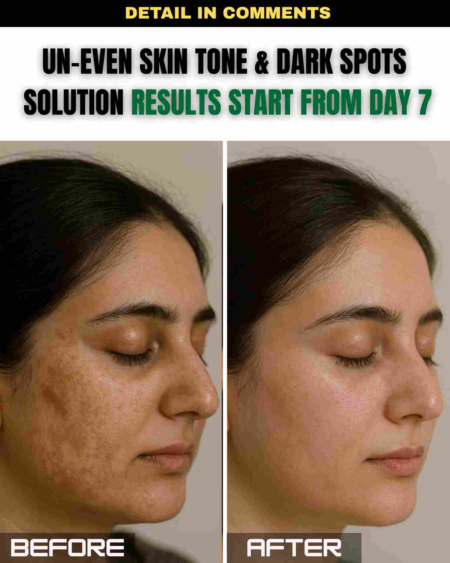 Uneven Skin Tone & Dark Spots Solution – Visible Results Start From Day 7