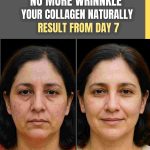 No More Wrinkles – Boost Your Collagen Naturally (Visible Results from Day 7)