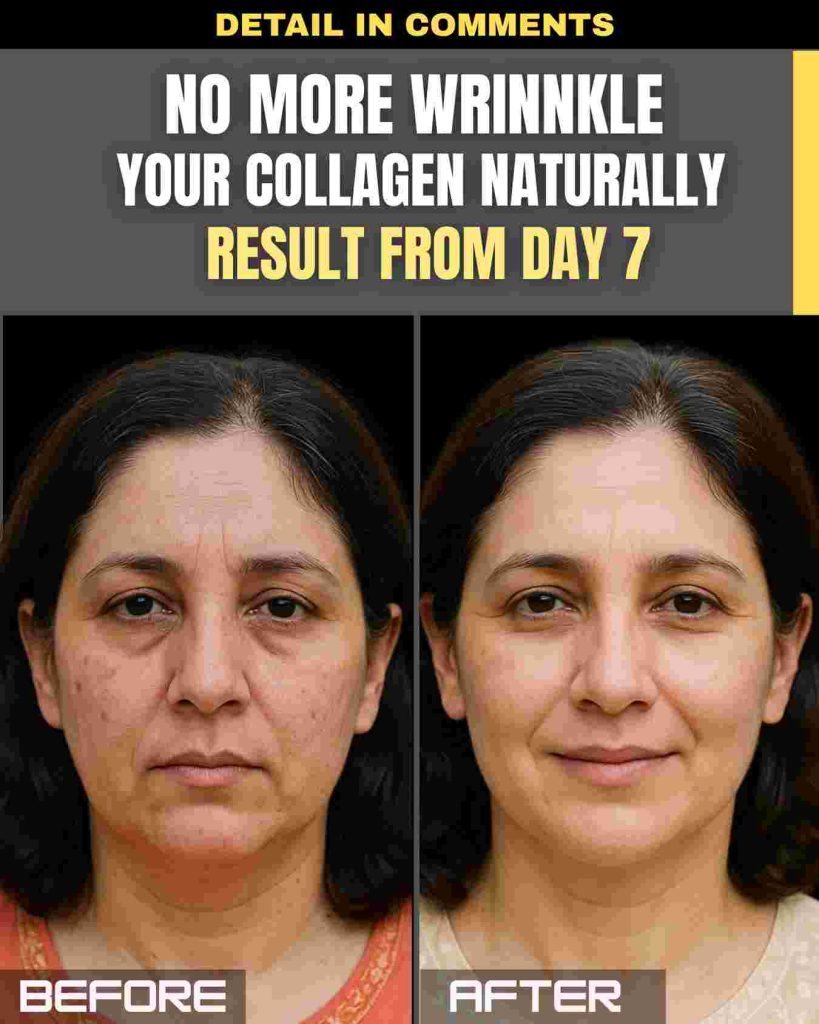 No More Wrinkles – Boost Your Collagen Naturally (Visible Results from Day 7)