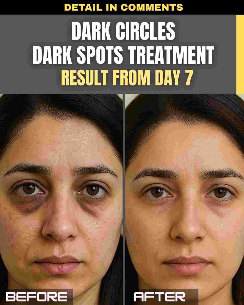 Dark Circles & Dark Spots Treatment – Visible Results from Day 7