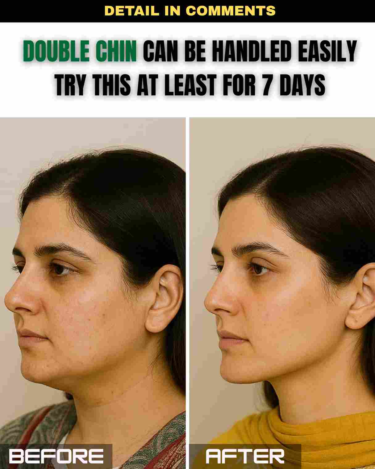 Double Chin Can Be Handled Easily – Try This for Just 7 Days!