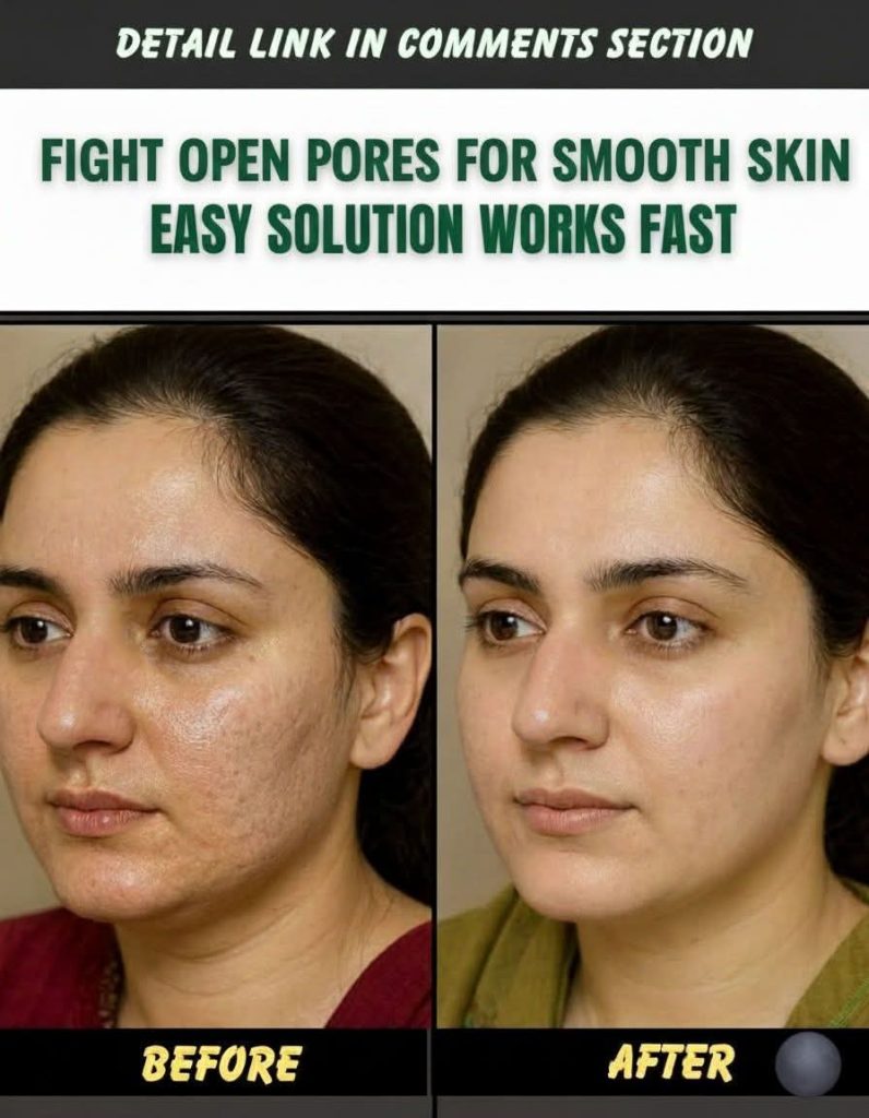 FIGHT OPEN PORES FOR SMOOTH SKIN – EASY NATURAL SOLUTIONS THAT WORK FAST