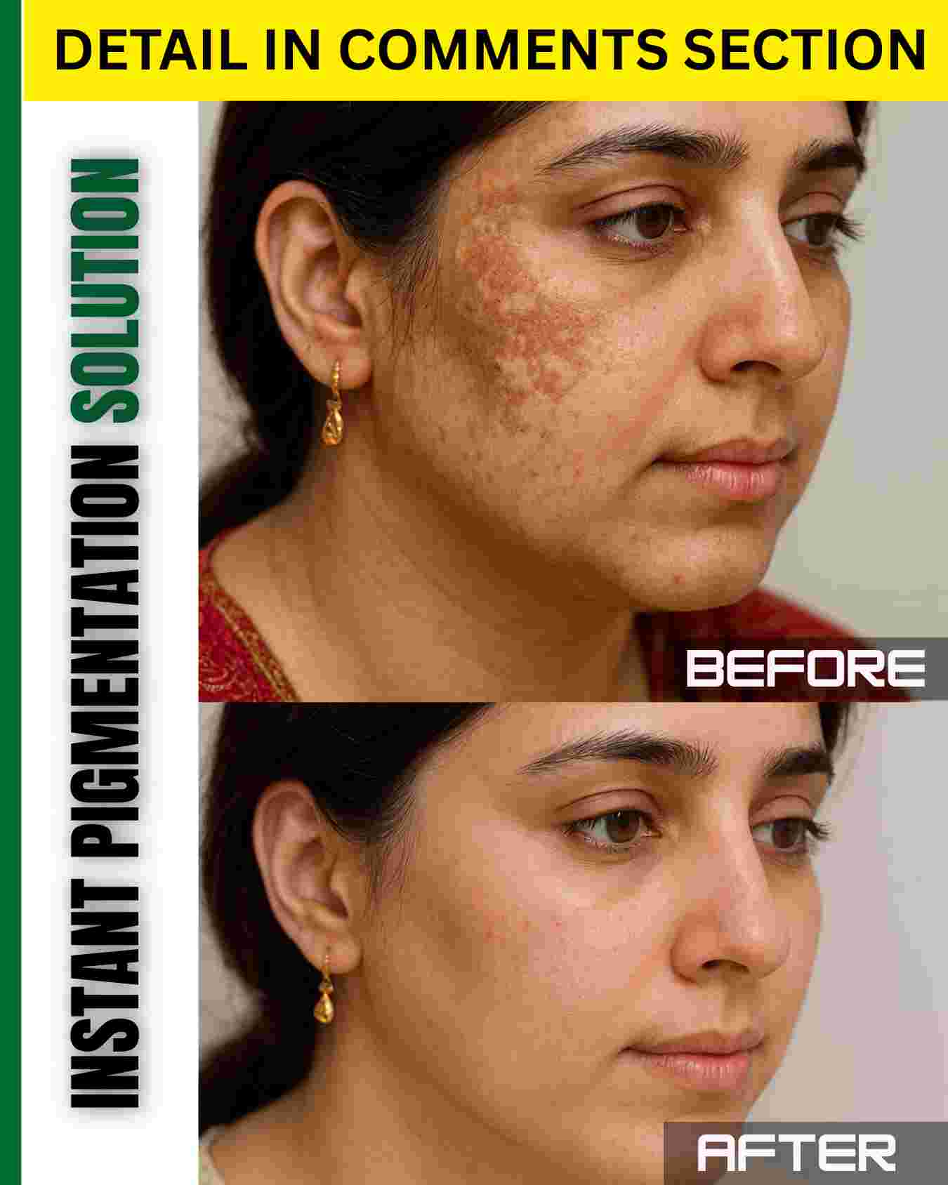 INSTANT PIGMENTATION SOLUTION – NATURAL REMEDIES BY SKIN TYPE