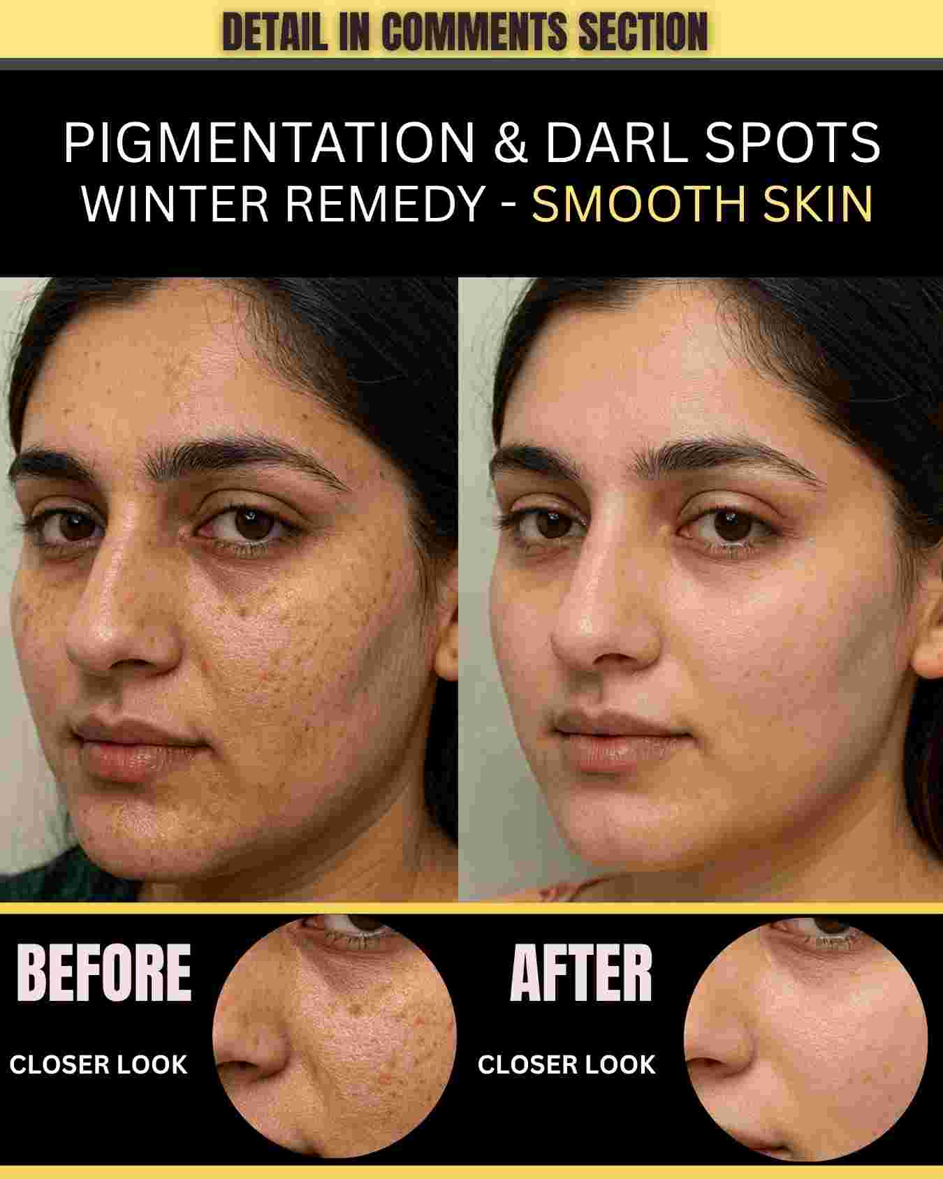 Pigmentation & Dark Spots – Winter Remedy for Smooth Skin (By Skin Type)