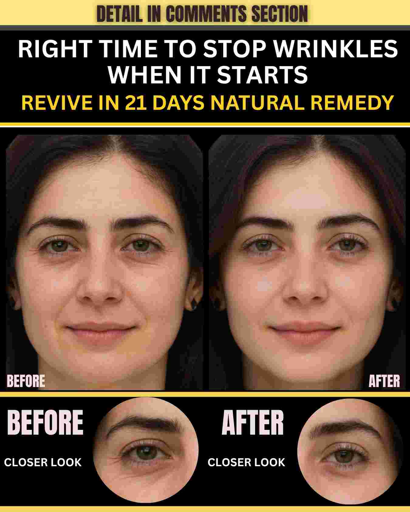 RIGHT TIME TO STOP WRINKLES — WHEN IT STARTS REVIVE IN 21 DAYS NATURAL REMEDY