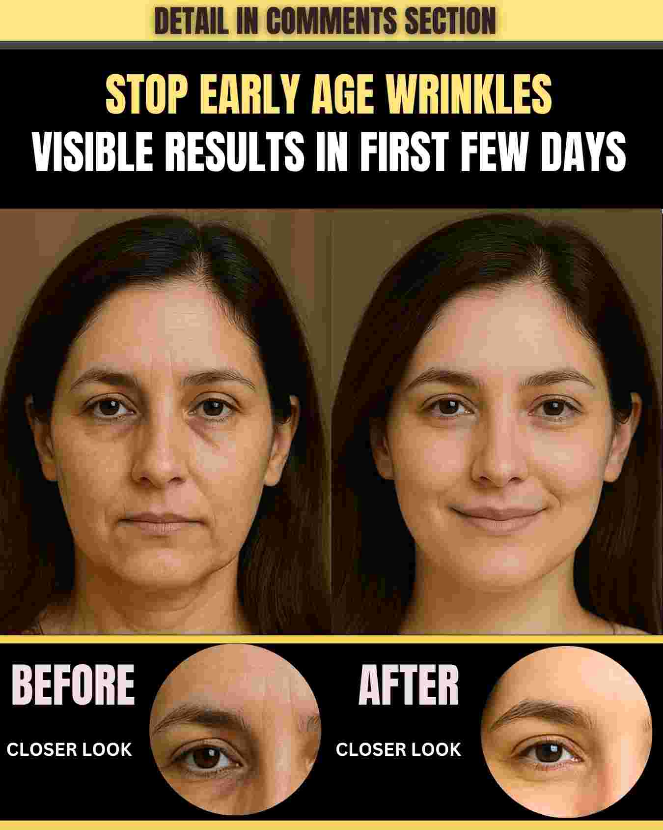 STOP EARLY AGE WRINKLES – VISIBLE RESULTS IN FIRST FEW DAYS