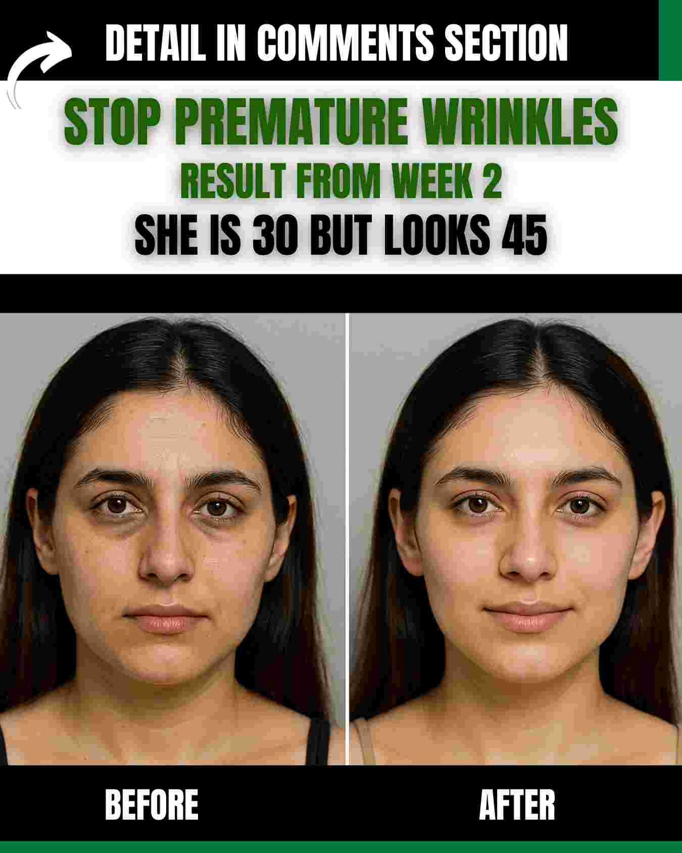 STOP PREMATURE WRINKLES — RESULT FROM WEEK 2