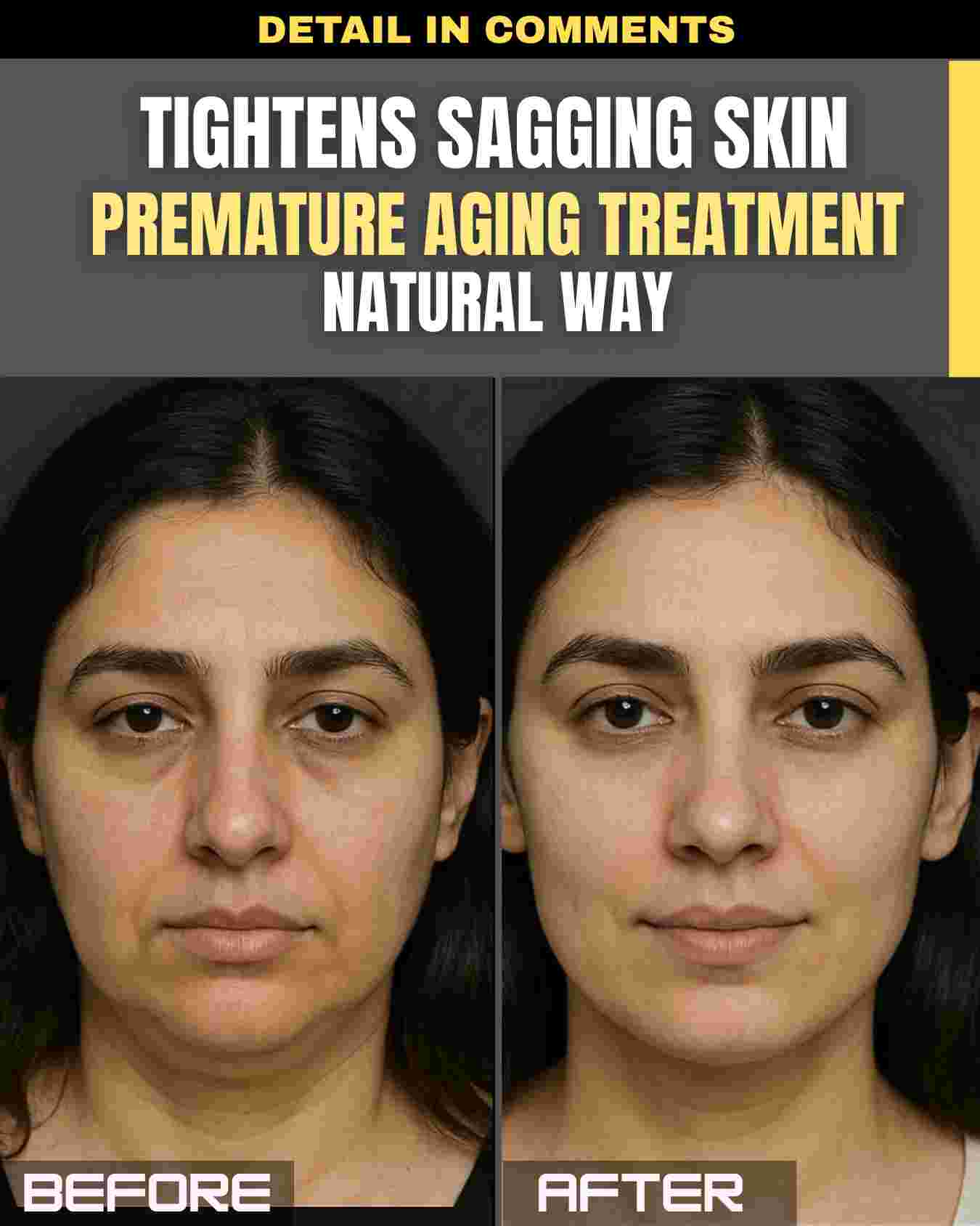 Tightens Sagging Skin & Premature Aging Treatment – The Natural Way