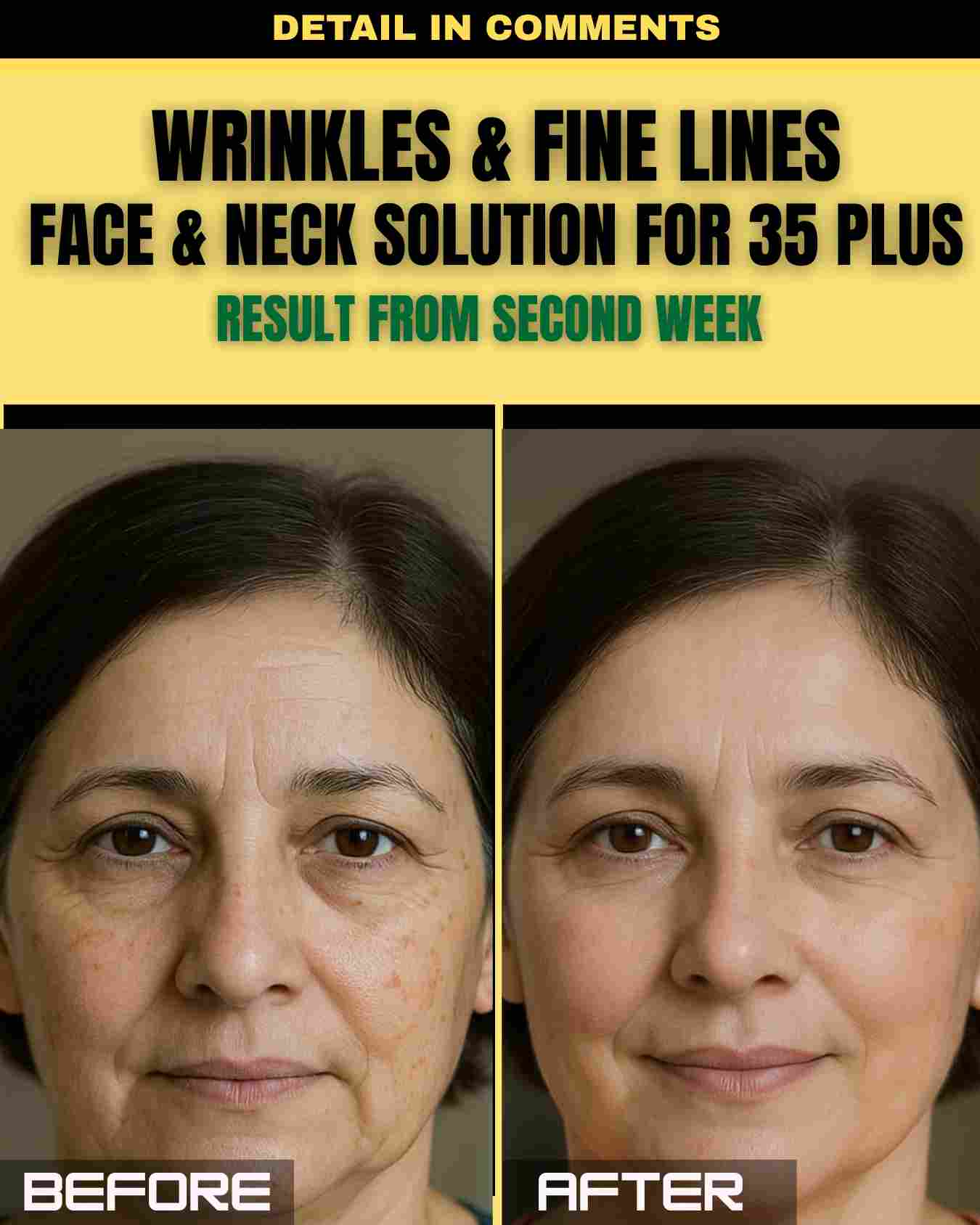 Wrinkles & Fine Lines Face & Neck Solution for 35+ (Results from Second Week)