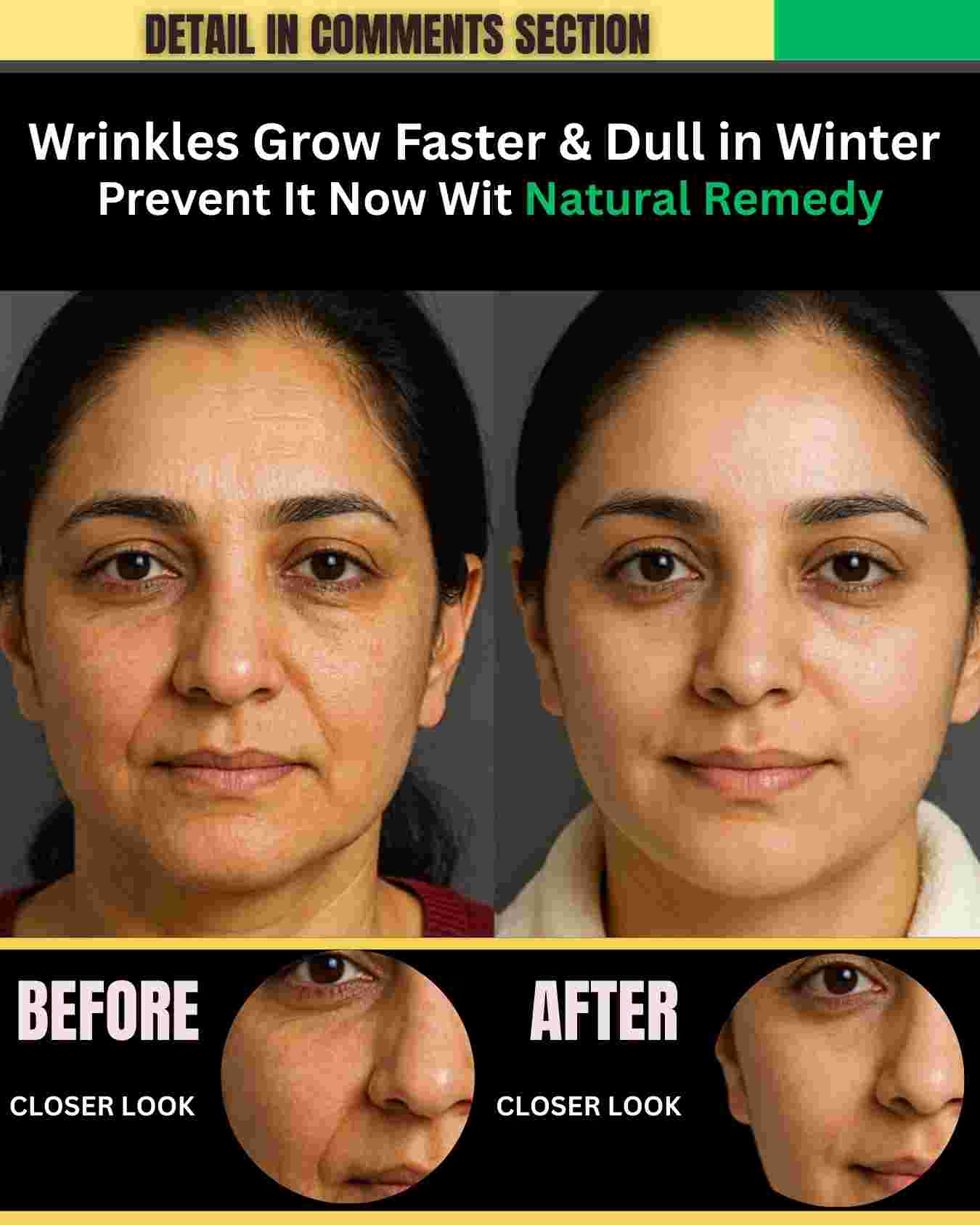 Wrinkles Grow Faster & Skin Looks Dull in Winter – Prevent It Now With Natural Remedies