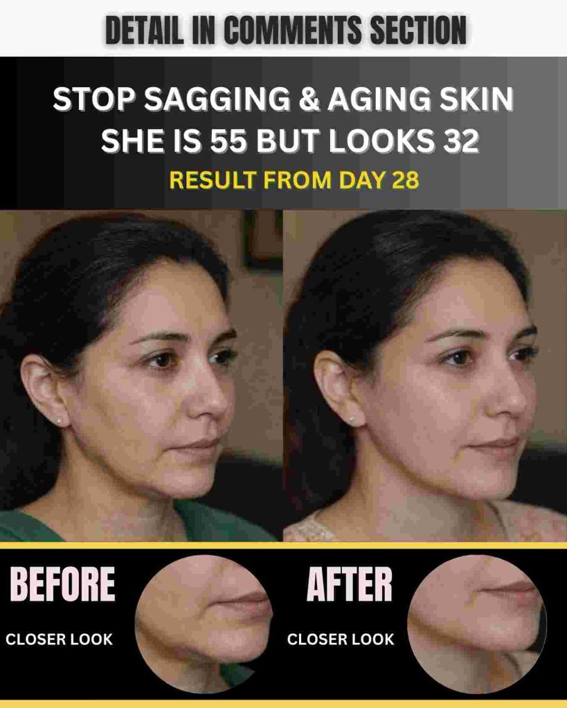 Stop Sagging & Aging Skin – She Is 55 but Looks 32