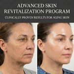 ADVANCED SKIN REVITALIZATION PROGRAM Proven Results for Aging Skin