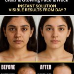 A clear and glowing face and a bright neck change the way your entire appearance feels. The neck often darkens faster because of sweat, friction, sun exposure, and buildup of dead skin.